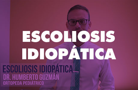 Dr. Humberto Guzmán: Escoliosis Idiopática